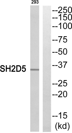 Western blot analysis of SH2D5 Antibody. The lane on the right is blocked with the SH2D5 peptide. Western blot analysis of SH2D5 Antibody. The lane on the right is blocked with the SH2D5 peptide.