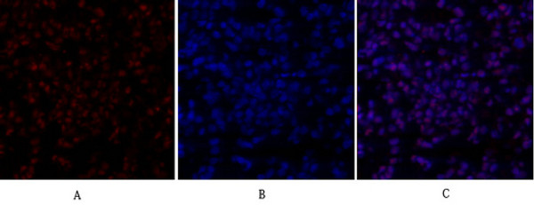 Immunofluorescence analysis of rat-lung tissue. 1, SIRT1 Polyclonal Antibody (red) was diluted at 1:200 (4°C, overnight). 2, Cy3 labled Secondary antibody was diluted at 1:300 (room temperature, 50min).3, Picture B: DAPI (blue) 10min. Picture A:Target. Picture B: DAPI. Picture C: merge of A+B