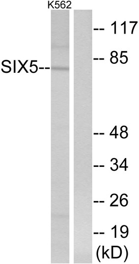 Western blot analysis of lysates from K562 cells, using SIX5 Antibody. The lane on the right is blocked with the synthesized peptide.