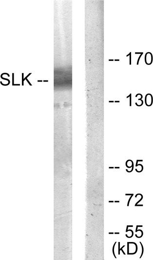 Western blot analysis of lysates from COLO205 cells, using SLK Antibody. The lane on the right is blocked with the synthesized peptide.