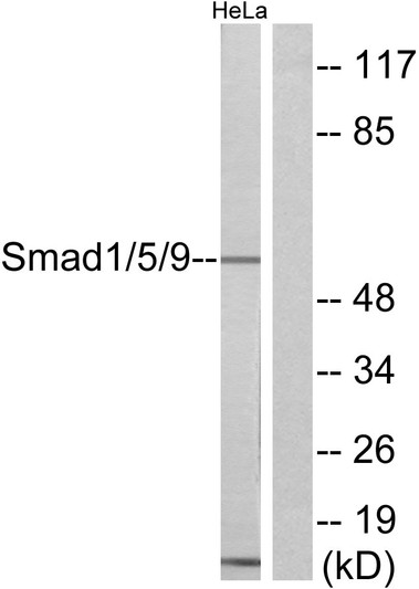 Western blot analysis of lysates from HeLa cells, using Smad1/5/9 Antibody. The lane on the right is blocked with the synthesized peptide.