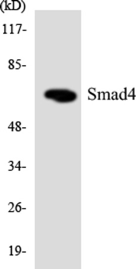 Western blot analysis of the lysates from HT-29 cells using Smad4 antibody.