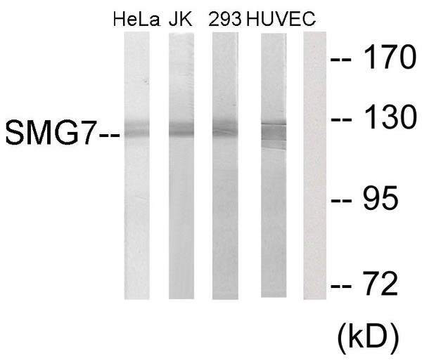 Western blot analysis of lysates from HeLa, Jurkat, 293, and HUVEC cells, using SMG7 Antibody. The lane on the right is blocked with the synthesized peptide.