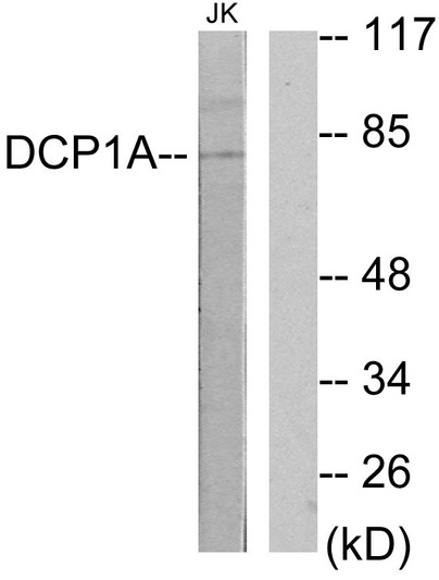 Western blot analysis of lysates from Jurkat cells, using DCP1A Antibody. The lane on the right is blocked with the synthesized peptide.