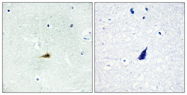 Immunohistochemistry analysis of paraffin-embedded human brain tissue, using NCOR2 Antibody. The picture on the right is blocked with the synthesized peptide.