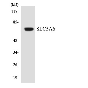 Western blot analysis of the lysates from COLO205 cells using SLC5A6 antibody.