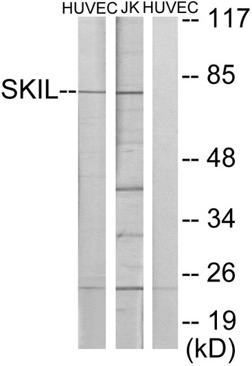 Western blot analysis of lysates from HUVEC and Jurkat cells, using SKIL Antibody. The lane on the right is blocked with the synthesized peptide.