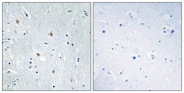 Immunohistochemistry analysis of paraffin-embedded human brain tissue, using SOX12 Antibody. The picture on the right is blocked with the synthesized peptide.