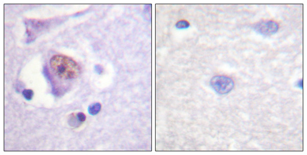 Immunohistochemistry analysis of paraffin-embedded human brain tissue, using SOX9 Antibody. The picture on the right is blocked with the synthesized peptide.