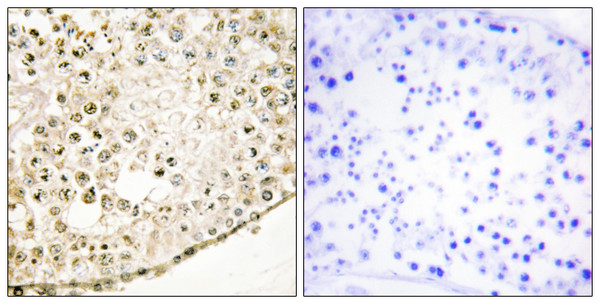 Immunohistochemistry analysis of paraffin-embedded human testis tissue, using SPZ1 Antibody. The picture on the right is blocked with the synthesized peptide.