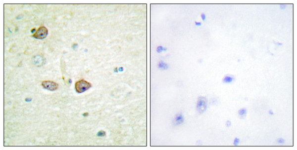 Immunohistochemistry analysis of paraffin-embedded human brain tissue, using 5-HT-1B Antibody. The picture on the right is blocked with the synthesized peptide.