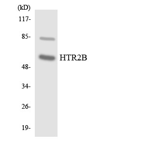 Western blot analysis of the lysates from COLO205 cells using HTR2B antibody.