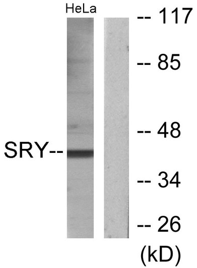 Western blot analysis of lysates from HeLa cells, using SRY Antibody. The lane on the right was blocked with the STJ95789