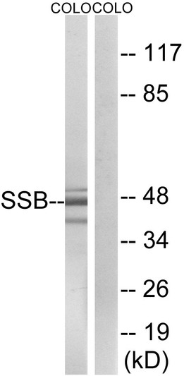 Western blot analysis of lysates from COLO cells, using SSB Antibody. The lane on the right is blocked with the synthesized peptide.