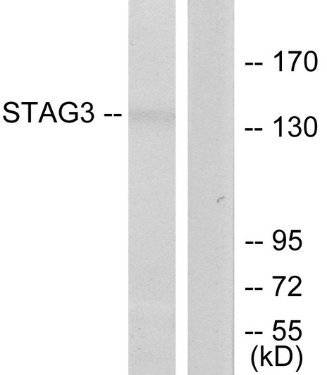 Western blot analysis of lysates from Jurkat cells, using STAG3 Antibody. The lane on the right is blocked with the synthesized peptide.