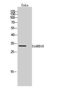 Western Blot analysis of CoLo cells using StARD10 Polyclonal Antibody STJ95802
