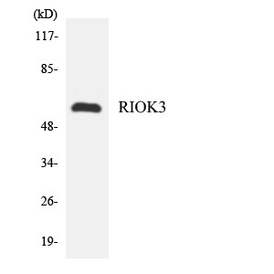 Western blot analysis of the lysates from HeLa cells using RIOK3 antibody.