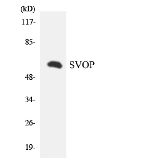 Western blot analysis of the lysates from Jurkat cells using SVOP antibody.