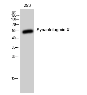 Western Blot analysis of 293 cells using Synaptotagmin X Polyclonal Antibody STJ95851