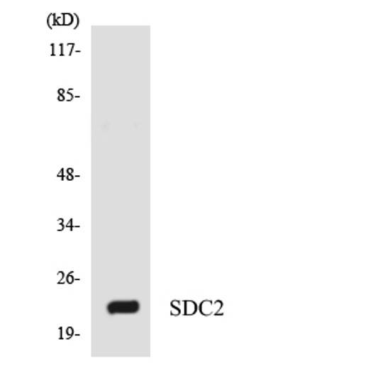 Western blot analysis of the lysates from RAW264.7cells using SDC2 antibody.