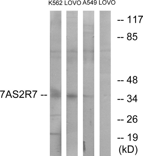 Western blot analysis of lysates from K562, LOVO, and A549 cells, using TAS2R7 Antibody. The lane on the right is blocked with the synthesized peptide.