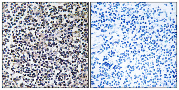 Immunohistochemistry analysis of paraffin-embedded human tonsil tissue, using TACC3 Antibody. The picture on the right is blocked with the synthesized peptide.