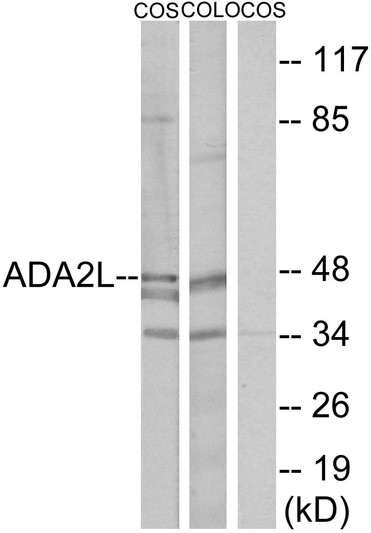 Western blot analysis of lysates from COS7 and COLO205 cells, using ADA2L Antibody. The lane on the right is blocked with the synthesized peptide.
