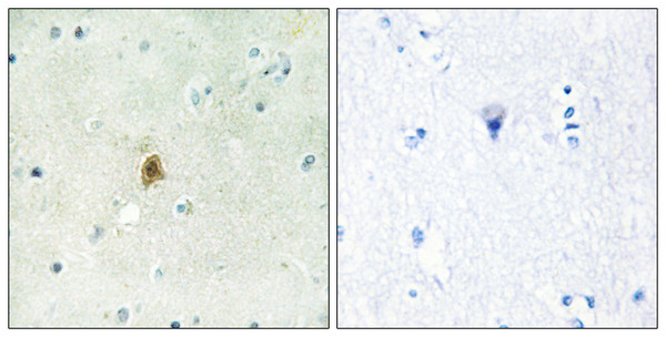 Immunohistochemistry analysis of paraffin-embedded human brain tissue, using TAF15 Antibody. The picture on the right is blocked with the synthesized peptide. Immunohistochemistry analysis of paraffin-embedded human brain tissue, using TAF15 Antibody. The picture on the right is blocked with the synthesized peptide.