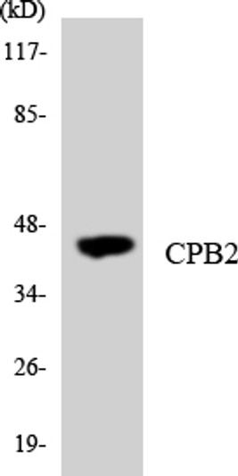 Western blot analysis of the lysates from K562 cells using CPB2 antibody. Western blot analysis of the lysates from K562 cells using CPB2 antibody.