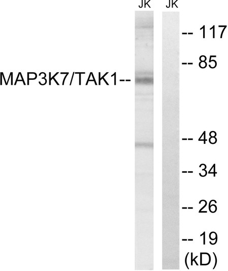 Western blot analysis of lysates from Jurkat cells, treated with heat shock, using MAP3K7 Antibody. The lane on the right is blocked with the synthesized peptide.