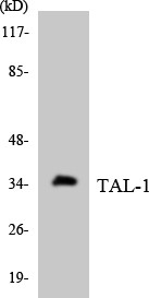 Western blot analysis of the lysates from HT-29 cells using TAL-1 antibody.