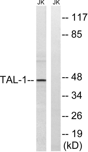 Western blot analysis of lysates from Jurkat cells treated with PMA 125ng/ml for 30', using TAL-1 Antibody. The lane on STJ95903