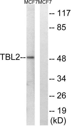 Western blot analysis of lysates from MCF-7 cells, using TBL2 Antibody. The lane on the right was blocked with the STJ95927
