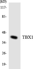 Western blot analysis of the lysates from 293 cells using TBX1 antibody.