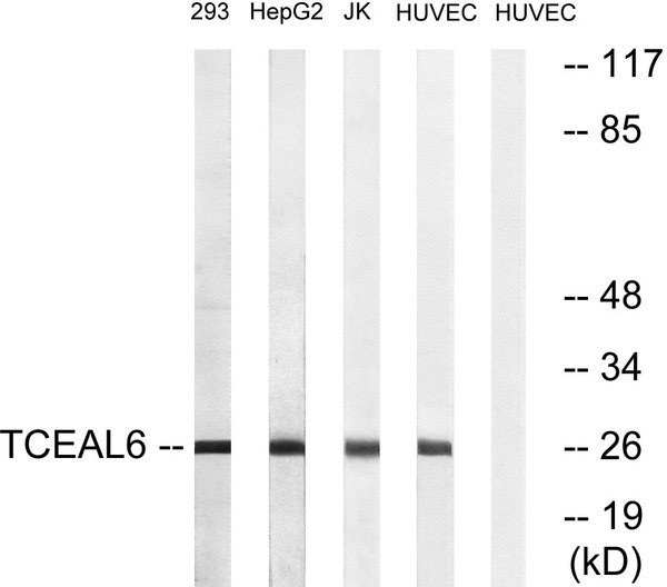 Western blot analysis of lysates from HUVEC, 293, HepG2, and Jurkat cells, using TCEAL6 Antibody. The lane on the right is blocked with the synthesized peptide. Western blot analysis of lysates from HUVEC, 293, HepG2, and Jurkat cells, using TCEAL6 Antibody. The lane on the right is blocked with the synthesized peptide.