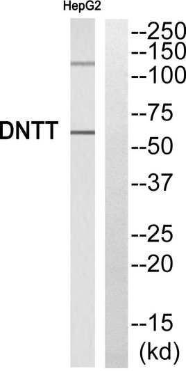 Western blot analysis of DNTT Antibody. The lane on the right is blocked with the DNTT peptide.