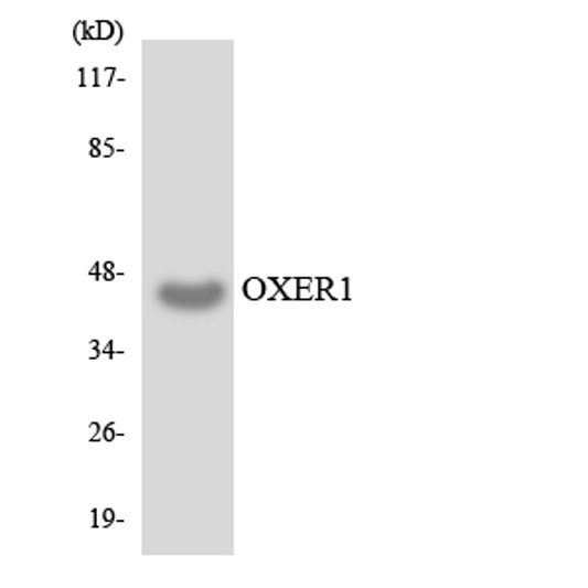 Western blot analysis of the lysates from HUVECcells using OXER1 antibody.