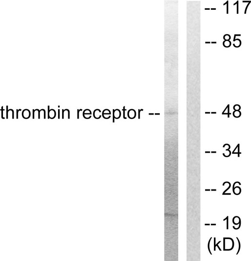 Western blot analysis of lysates from HeLa cells, treated with Nocodazole 1ug/ml 18h, using Thrombin Receptor Antibody. The lane on the right is blocked with the synthesized peptide.