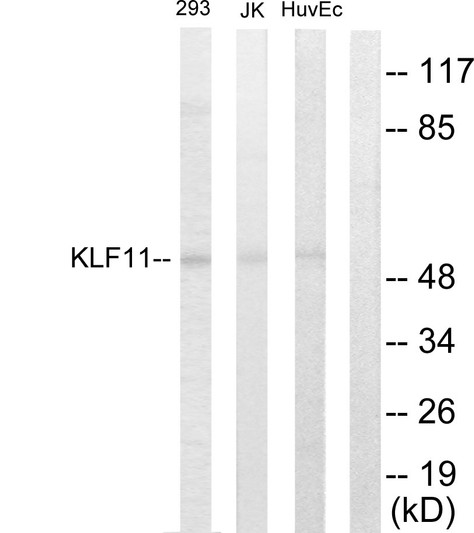 Western blot analysis of lysates from 293, Jurkat, and HUVEC cells, using KLF11 Antibody. The lane on the right is blocked with the synthesized peptide.