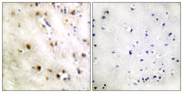 Immunohistochemistry analysis of paraffin-embedded human brain tissue, using TISB Antibody. The picture on the right is blocked with the synthesized peptide.