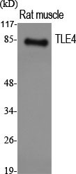 Western blot analysis of various cells using TLE4 polyclonal antibody. Secondary antibody was STJ96036