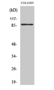 Western blot analysis of various cells using TLK2 polyclonal antibody. Secondary antibody was STJ96039