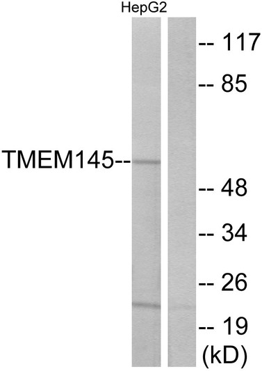 Western blot analysis of lysates from HepG2 cells, using TMEM145 Antibody. The lane on the right is blocked with the synthesized peptide.