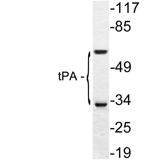 Western blot analysis of lysate from A549 cells, using tPA antibody.