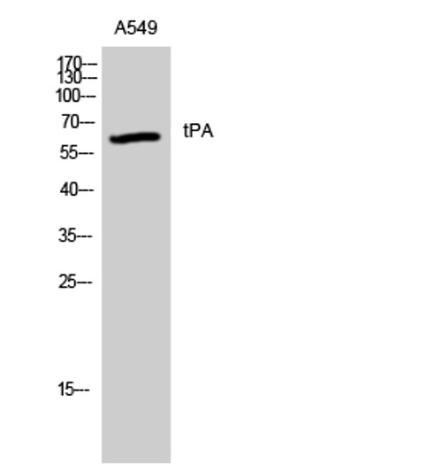 Western blot analysis of A549 cells using tPA Polyclonal Antibody. Secondary antibody was diluted at 1:20000