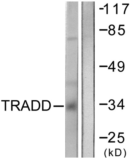 Western blot analysis of lysates from COS7 cells, using TRADD Antibody. The lane on the right is blocked with the synthesized peptide.