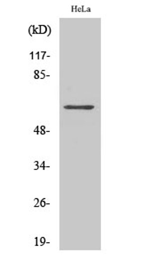 Western blot analysis of COLO205 cells using TRAF3 Polyclonal Antibody. Secondary antibody was diluted at 1:20000