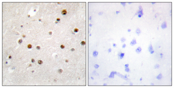 Immunohistochemistry analysis of paraffin-embedded human brain tissue, using TSN Antibody. The picture on the right is blocked with the synthesized peptide. Immunohistochemistry analysis of paraffin-embedded human brain tissue, using TSN Antibody. The picture on the right is blocked with the synthesized peptide.