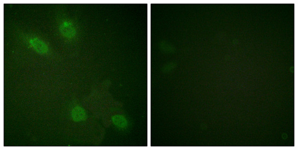 Immunofluorescence analysis of HeLa cells, using PPAR-BP Antibody. The picture on the right is blocked with the synthesized peptide.