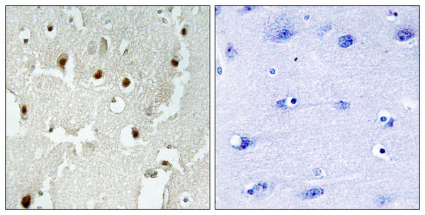 Immunohistochemistry analysis of paraffin-embedded human brain tissue, using TREF1 Antibody. The picture on the right is blocked with the synthesized peptide.